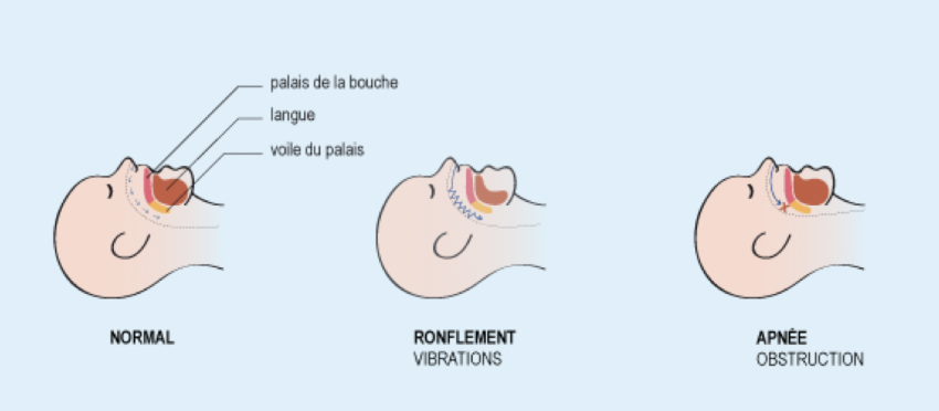 ventilation